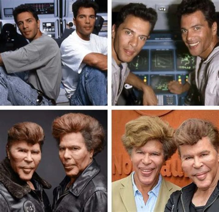 Unveiling The Secrets Of Plastic Surgery Twins: Discoveries And Insights